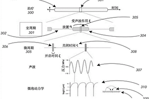 滚筒筛自清堵装置