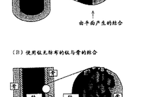 钛纤维医疗材料