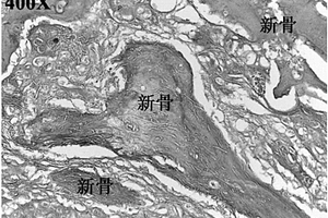 用于骨修复的纤维基三维多孔复合材料及其制备方法以及成型品