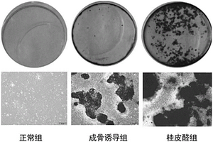 骨生长促进剂、生物复合材料及其制备方法和生物支架