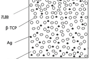 多相梯度分布的多孔Zn-Ag-TCP复合材料及其制备方法