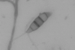 重金属抗性新拟盘多毛孢属微生物及其应用