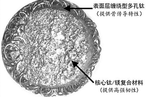 半降解钛镁复合微球骨填充医用材料