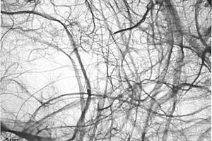 制造纳米纤维素的生物机械分丝方法