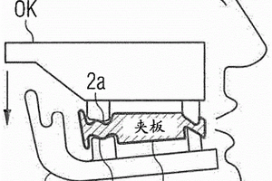 牙用夹板及其制作