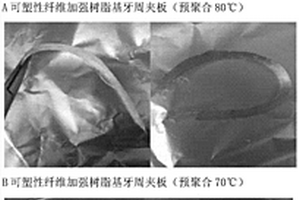 可塑性纤维增强树脂基牙周夹板材料及其制备方法
