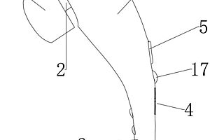 气道廓清治疗装置和方法