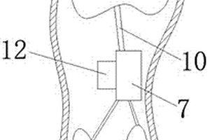 具有矫正功能的跑鞋