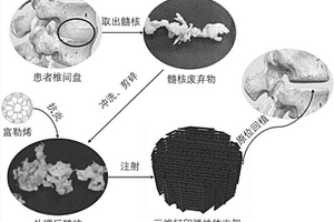 结合三维打印技术制备髓核回植体的方法