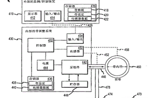 自调节胃带