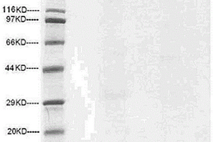 化学合成的HSV2病毒gE糖蛋白胞外区基因片段及其表达、应用