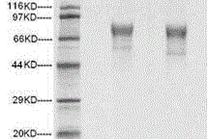 化学合成的HSV2病毒gC糖蛋白胞外区基因片段及其表达、应用