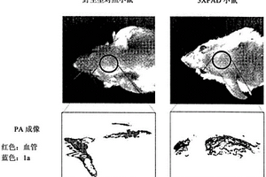 姜黄素衍生物、其制备方法、以及用于检测β-淀粉样蛋白斑的包含该姜黄素衍生物的光声成像剂