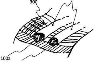 新型生物传感器及相关的伤口敷料系统