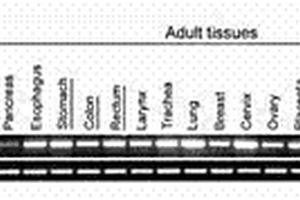 PCDH17基因的应用