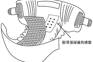 胶带基的尿液传感器