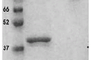 抗Galectin-3的全人源化单域抗体及应用