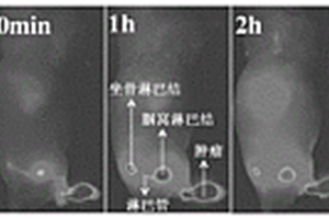 基于肿瘤前哨淋巴结探测的荧光造影剂及其制备方法