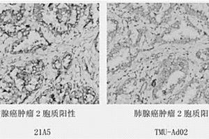 抗Napsin A蛋白的单克隆抗体及其细胞株、制备方法和应用