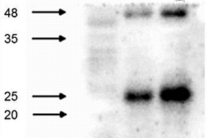 抗HPV16 E6蛋白的单克隆抗体及其应用
