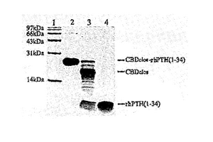 重组人甲状旁腺激素在大肠杆菌中的构建、表达与纯化方法