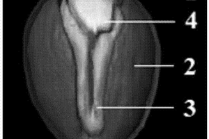 种子特异性部位油脂含量检测方法及其QTL位点鉴定方法