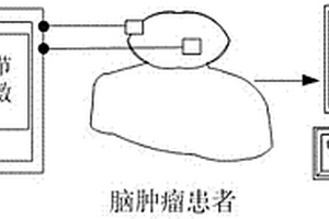 基于磁共振电阻抗成像的脑部肿瘤检测系统