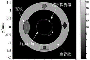 血管内光声图像的时间反演重建方法